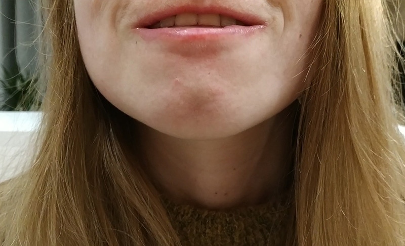 Odchylenie brody