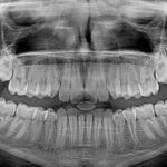 Współpraca logopedy z ortodontą