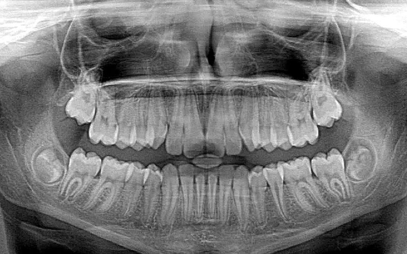 Współpraca logopedy z ortodontą
