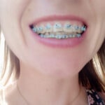 Logopeda z aparatem ortodontycznym